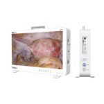 Camjoy CK927 портативная эндоскопическая камера 27 дюймов 4K UHD «все в одном»