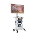 Башенная система эндоскопической камеры CF601 Full HD