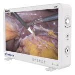 Camjoy CF924 24 Интегрированная система эндоскопической камеры FHD Медицинский центр визуализации FHD 01