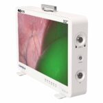 Camjoy CG932 32-дюймовый 4K-ICG FPGA Эндоскоп-камера 02