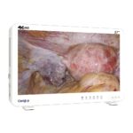 Camjoy CK927 27 4K Ultra HD эндоскопическая камера Surgical Clarity 4K 03