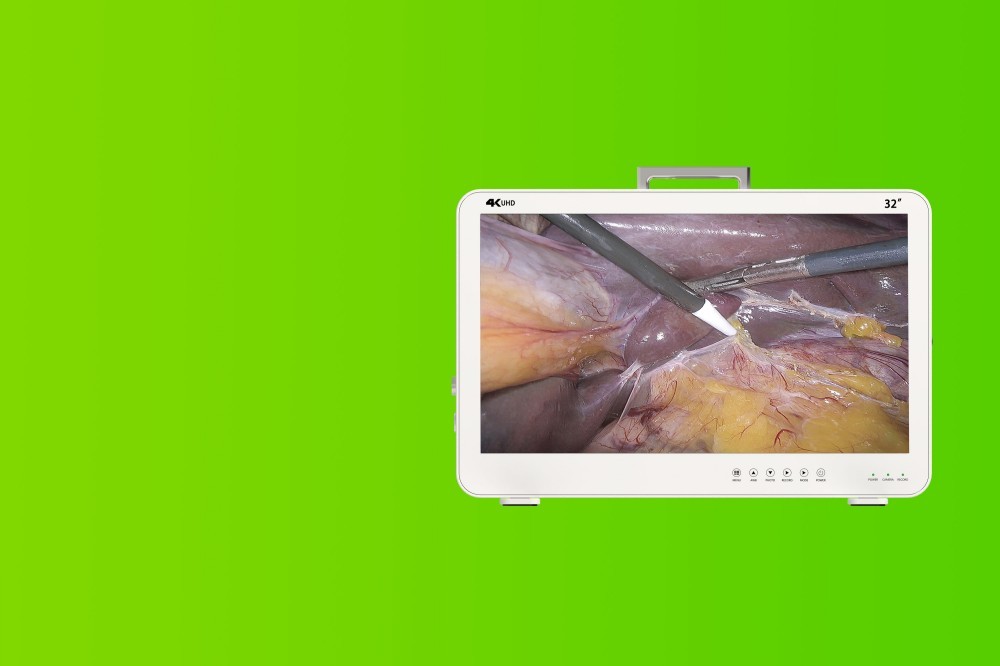 Camjoy FHD 4K portable endoscope camera system