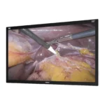 Camjoy CK1 55-inch black 4K surgical monitor perspective view